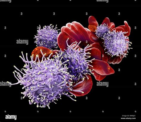 Activated T Lymphocytes And Red Blood Cells Rbcs Coloured Scanning