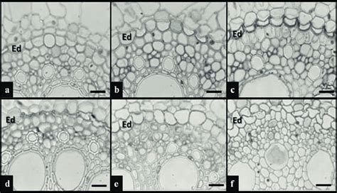 Photomicrographs Of Transverse Sections Of The Roots Of Brachiaria Download Scientific Diagram