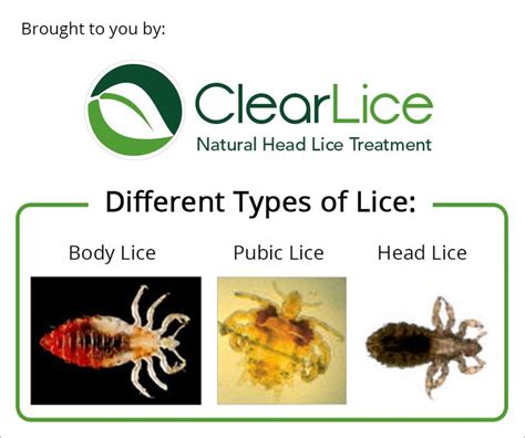 17 Best images about Natural Lice Treatment and Prevention on Pinterest ...