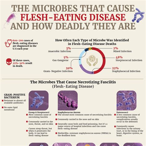 microbes   flesh eating disease   deadly