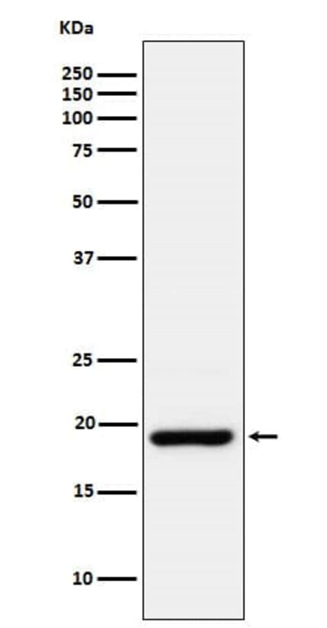 CIRBP Antibody SR1307 Novus Biologicals 50 μg Unconjugated