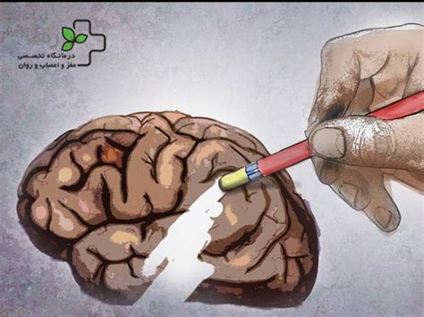 آلزایمر چیست؟ دلایل و علائم آلزایمر ،راه های تشخیص و درمان آلزایمر