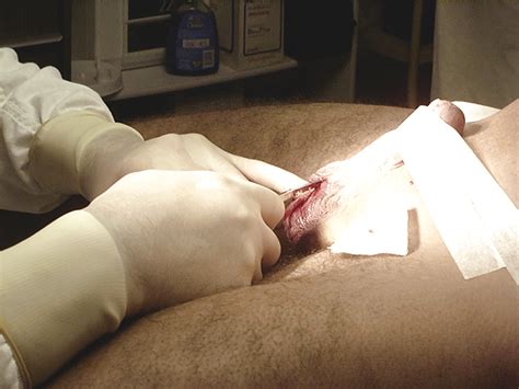 Kastriert Trannies Kastration Orchectomy Porno Bilder Sex Fotos Xxx Bilder Pictoa