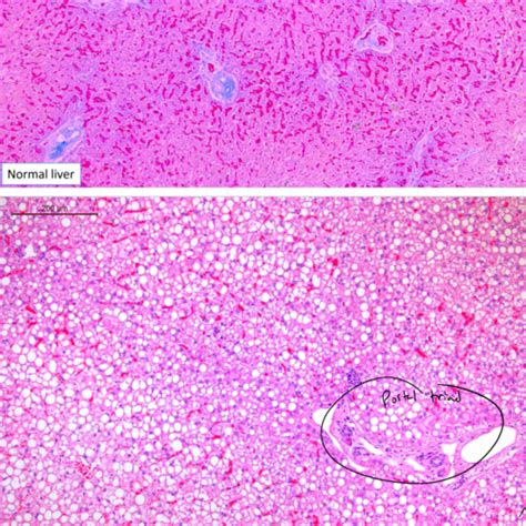 1 Cell Injury Path Flashcards Quizlet