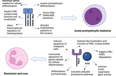 How Retinoic Acid And Arsenic Transformed Acute Promyelocytic Leukemia