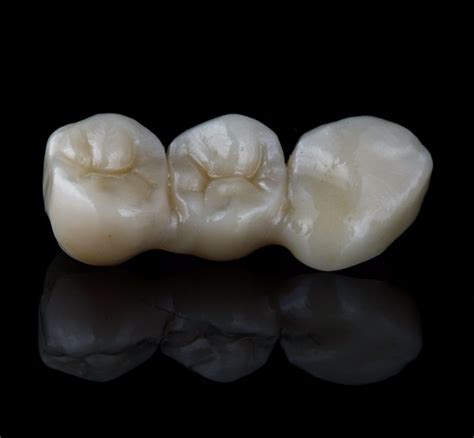 Crowns And Full Veneers In Turkey Findglob