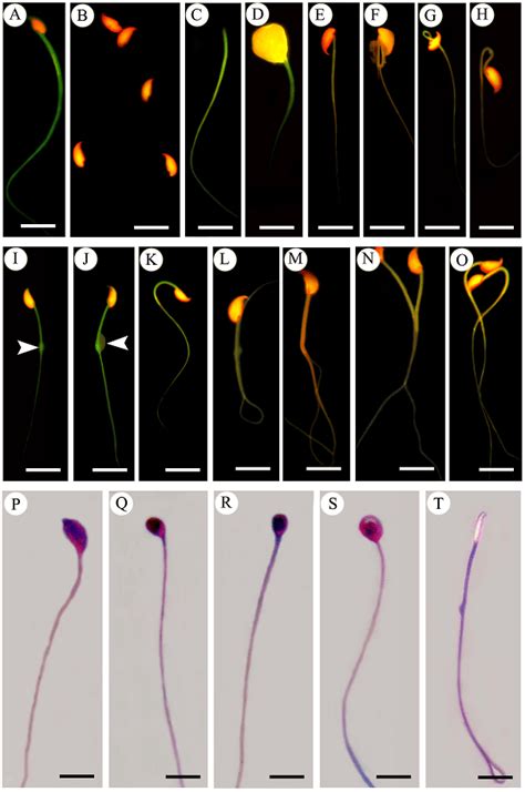 Ao Eb A O Giemsa S P T Stained Spermatozoa Of Control A And Q Download Scientific