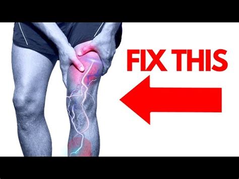 How to Fix Thigh and Leg (Femoral Nerve) Pain Fast | Meralgia ...