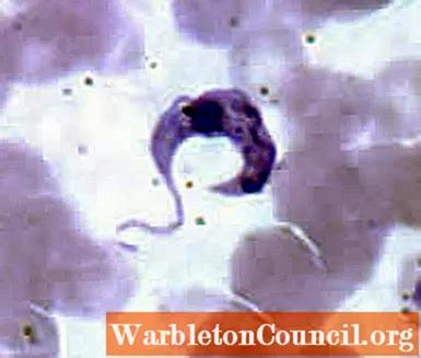 Trypanosoma cruzi: characteristics, life cycle, diseases, symptoms ...