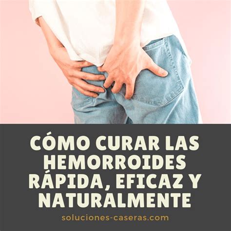 Cómo Curar Las Hemorroides Rápida Eficaz Y Naturalmente Curar