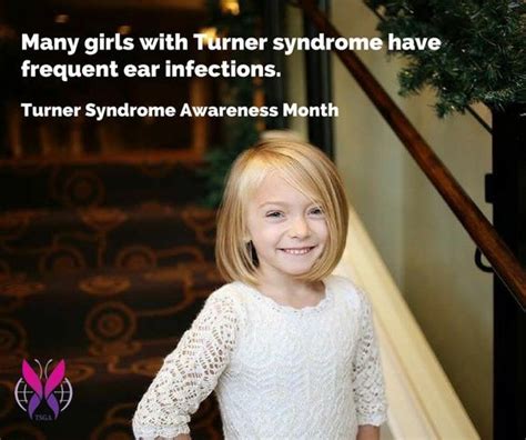 Linda Hunt Turner Syndrome