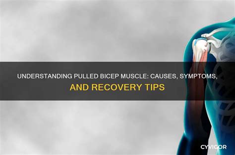 how to know if i pulled my bicep