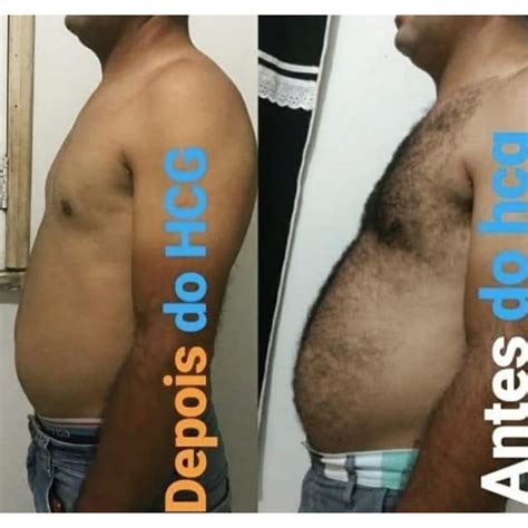 Hidroginástica Antes E Depois - Dieta Hcg Antes E Depois - RETOEDU
