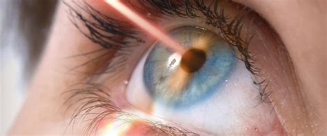 The Pros and Cons of Laser Eye Surgery