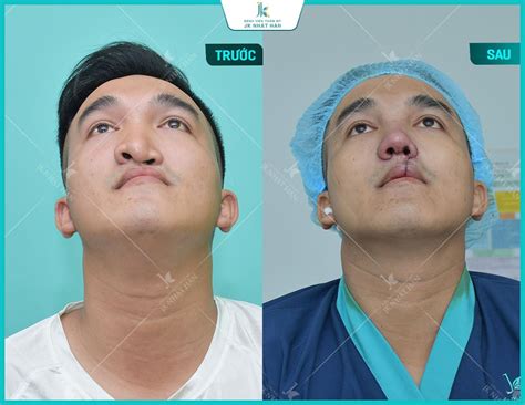 Top C C D Ng M I Hot Trend Gi I Tr Ng Flex