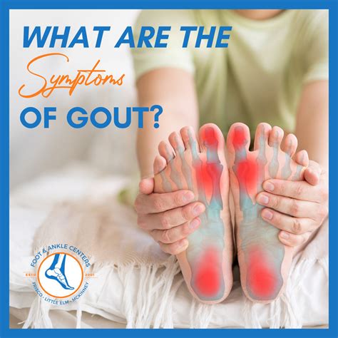 What Are Gout Symptoms? - Foot & Ankle Centers of Frisco and Plano