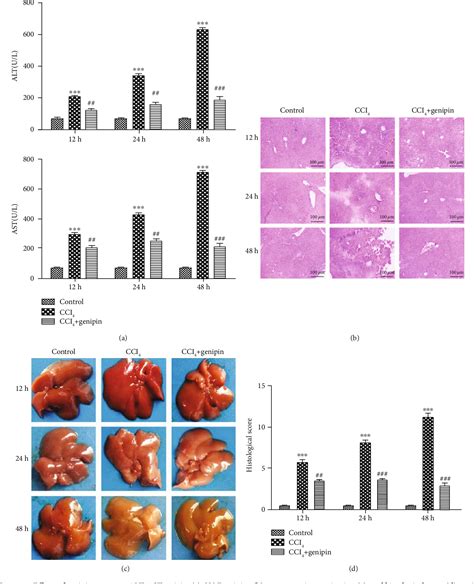 Figure 1 From Genipin Ameliorates Carbon Tetrachloride Induced Liver