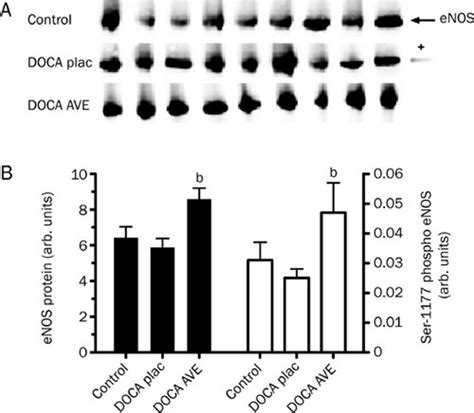 Myocardial Expression And Ser 1177 Phosphorylation Of Enos In Docaunx Download Scientific