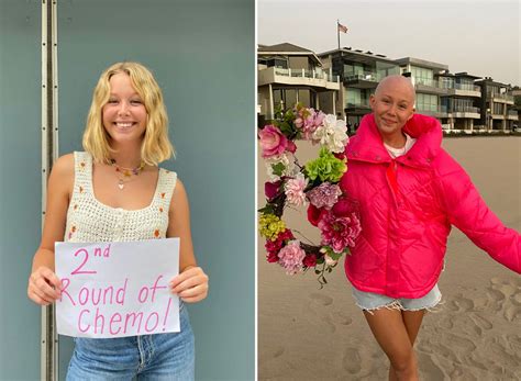 Miranda McKeon, 20, Shares Her Breast Cancer Story