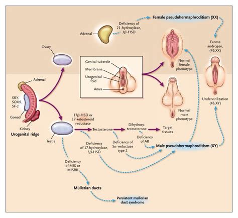 Sex Determination And Differentiation New England Journal Of Medicine