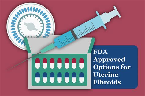 FDA Approved Options for Uterine Fibroids - EMMA International