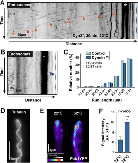 Retrograde Motility Of Ees In Conditional Dynein Mutants A Kymograph