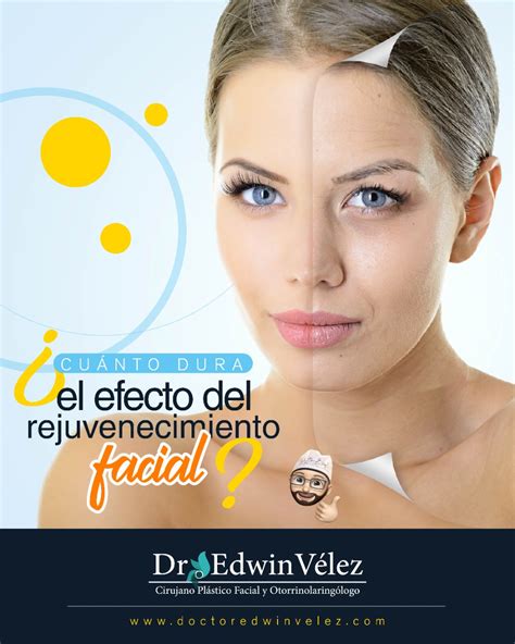 Qu Es El Lifting Facial O Rejuvenecimiento Facial Doctor Edwin V Lez