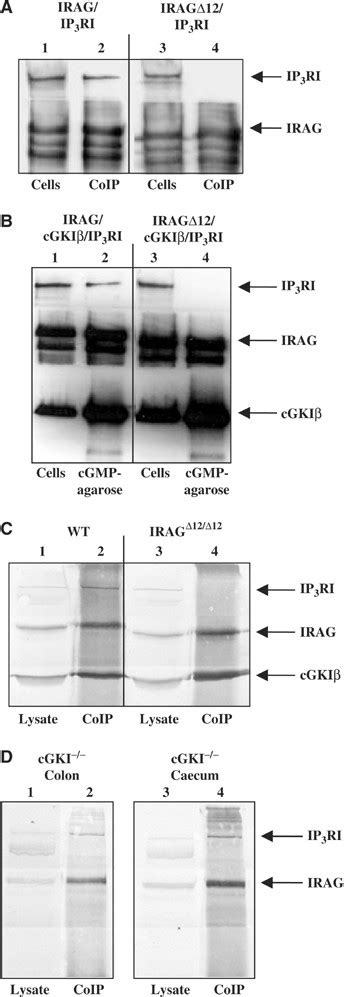 Interaction Of Irag With Ip3ri And Cgkiβ In Cos 7 Cells And Smooth