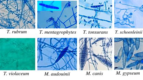 Microsporum Audouinii