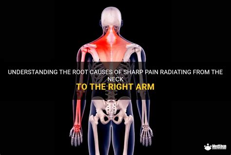 Understanding The Root Causes Of Sharp Pain Radiating From The Neck To