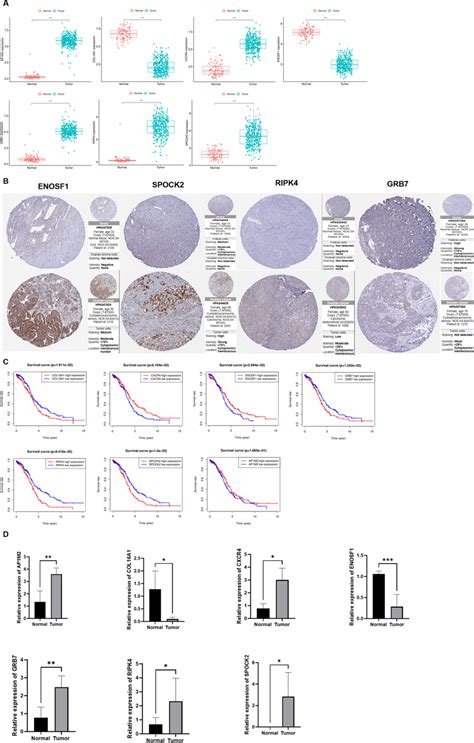 Validation Of Model Gene Expression And Survival A Expression Of The