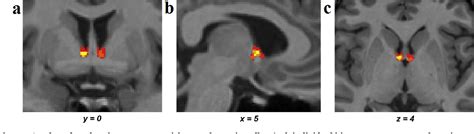 Figure 1 From Three Distinct Fiber Pathways Of The Bed Nucleus Of The