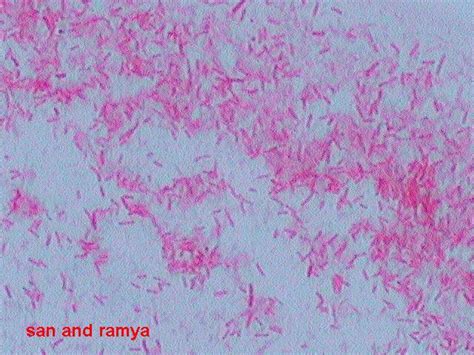 Pseudomonas Aeruginosa Gram Stain Morphology