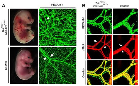 Figures And Data In Angiopoietin Receptor Tie Is Required For Vein