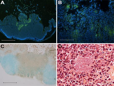 Persistent Y Pseudotuberculosis Resides In Cecal Tissue In The Download Scientific Diagram