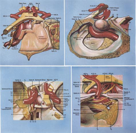 Sphenoid Sinus Anatomy Anatomical Charts And Posters