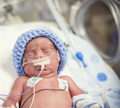 Newborn premature baby in the NICU intensive care - Archie 