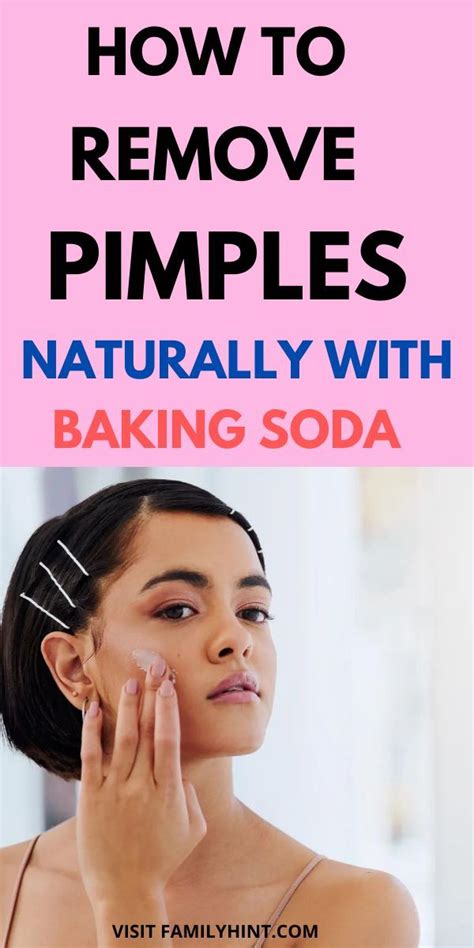 How To Get Rid Of Pimples Overnight 10 Home Remedies For Pimples Artofit