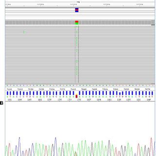 A The I1307K Variant In The APC Gene By Next Generation Sequencing