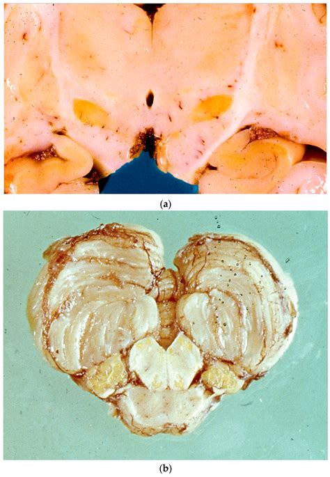 Diagnostics Free Full Text Clinicopathological Spectrum Of