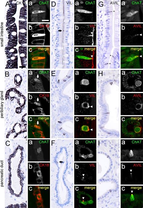 Presence of tuft cell morphology markers in ChAT-immunoreactive tuft ...