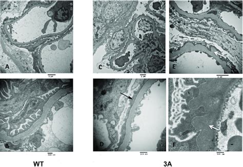 Transmission Electron Microscopy Of Glomeruli Of Wild Type WT Left