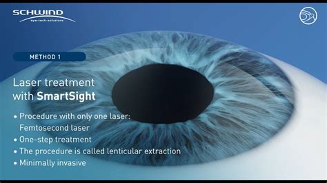 Lenticule Extraction Smartsight With Schwind Atos Femtosecond Laser