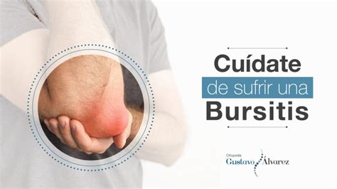 Cuídate de una bursitis Dr Gustavo Álvarez