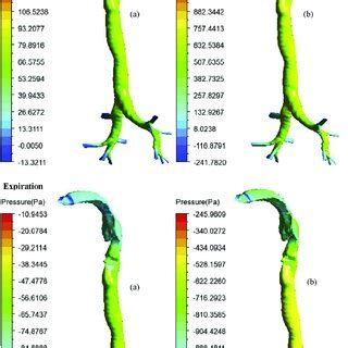 Wall Shear Stress Distributions For Respiration Response To A Walking