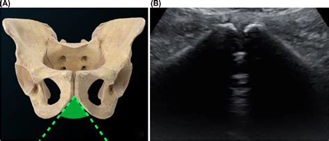 Ultrasound In Labor Clinical Practice Guideline And Recommendation By