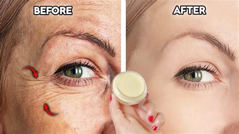 Years Looks The Best Collagen Works To Erase All Wrinkles From