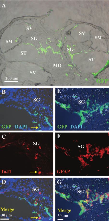 Survival And Differentiation Of Neural Stem Cells Nscs Grafted Into