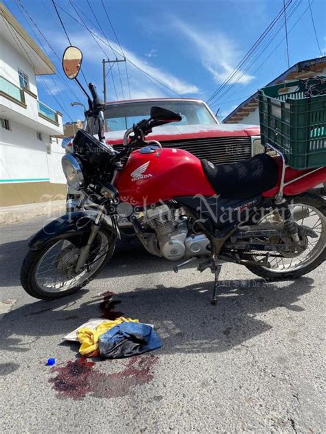 Motociclista Resulta Herido Tras Ser Arrollado Por Camioneta En Xalisco