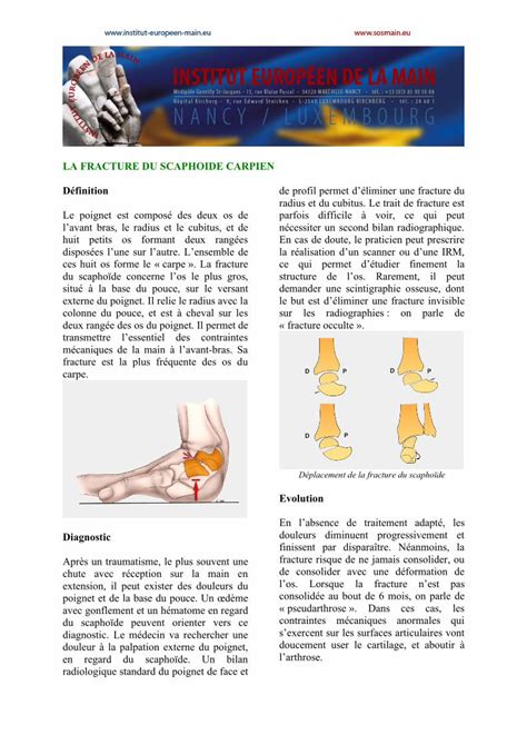 PDF LA FRACTURE DU SCAPHOIDE CARPIEN Institut LA FRACTURE DU